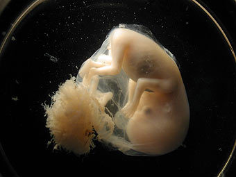 Эмбрион человека. Фото с сайта wikipedia.org