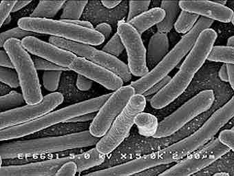   Escherichia coli.  Rocky Mountain Laboratories, NIAID, NIH